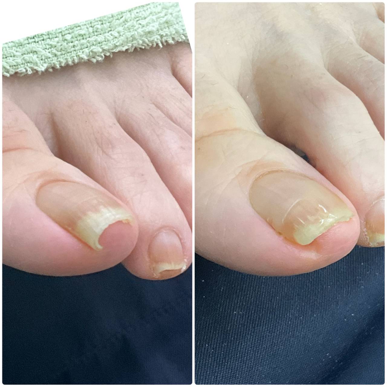 初回でこの変化