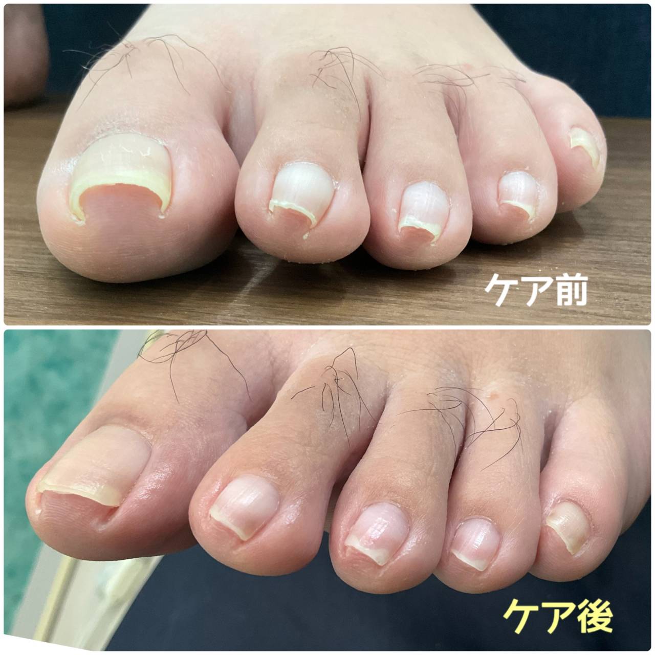 爪の両端が巻いていて切りにくい、、、そんなときは当店へお任せください