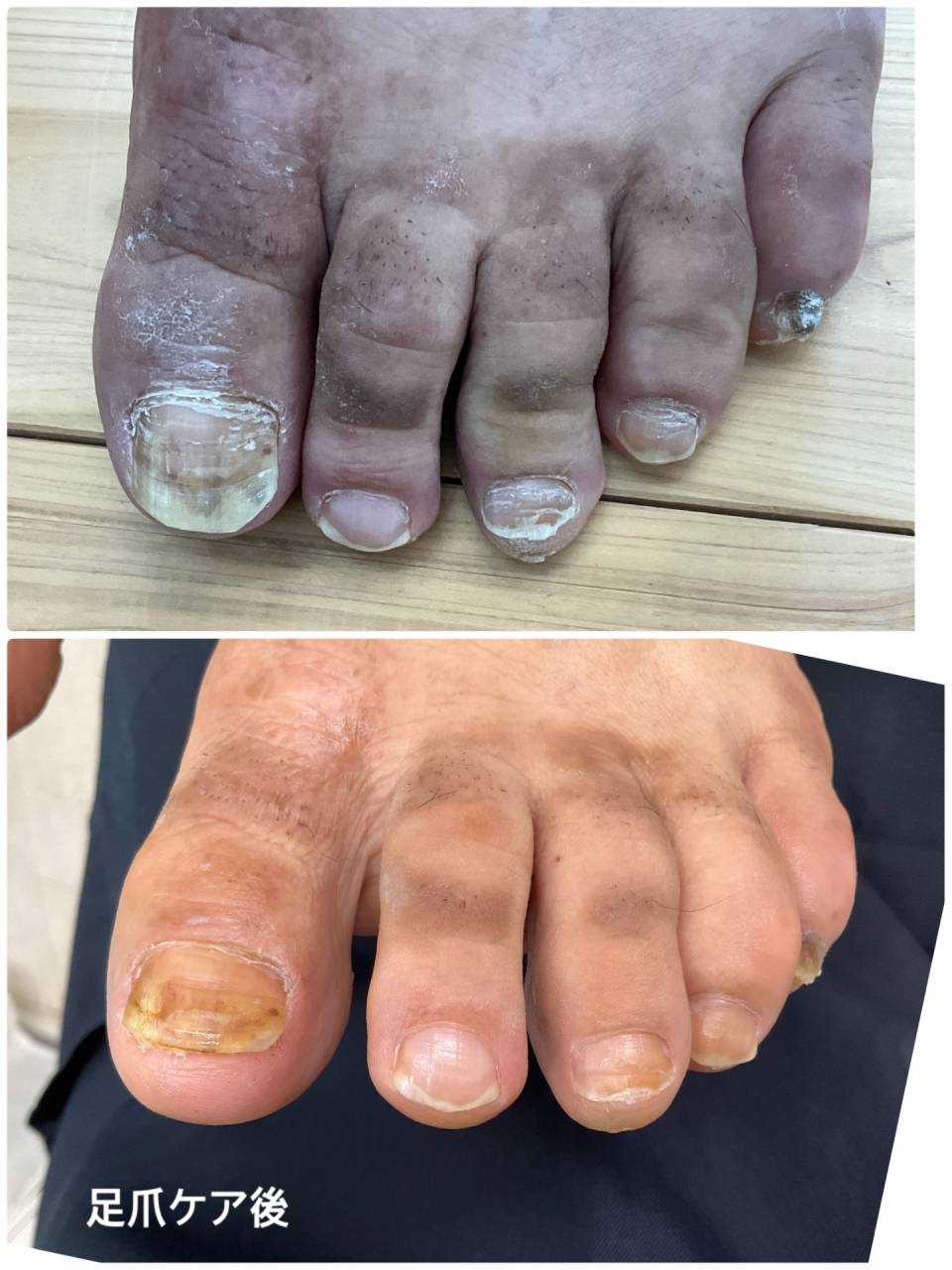 仕事柄、爪や皮膚にダメージが多いのですが、丁寧にケアをすることでトラブルの悪化を防ぐことができます。