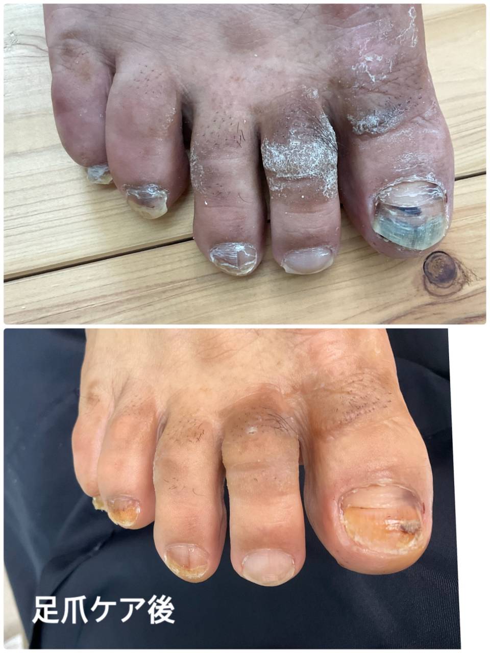 仕事柄、爪や皮膚のダメージが多くありますが、丁寧にケアすることでトラブル悪化を防ぐことができます。